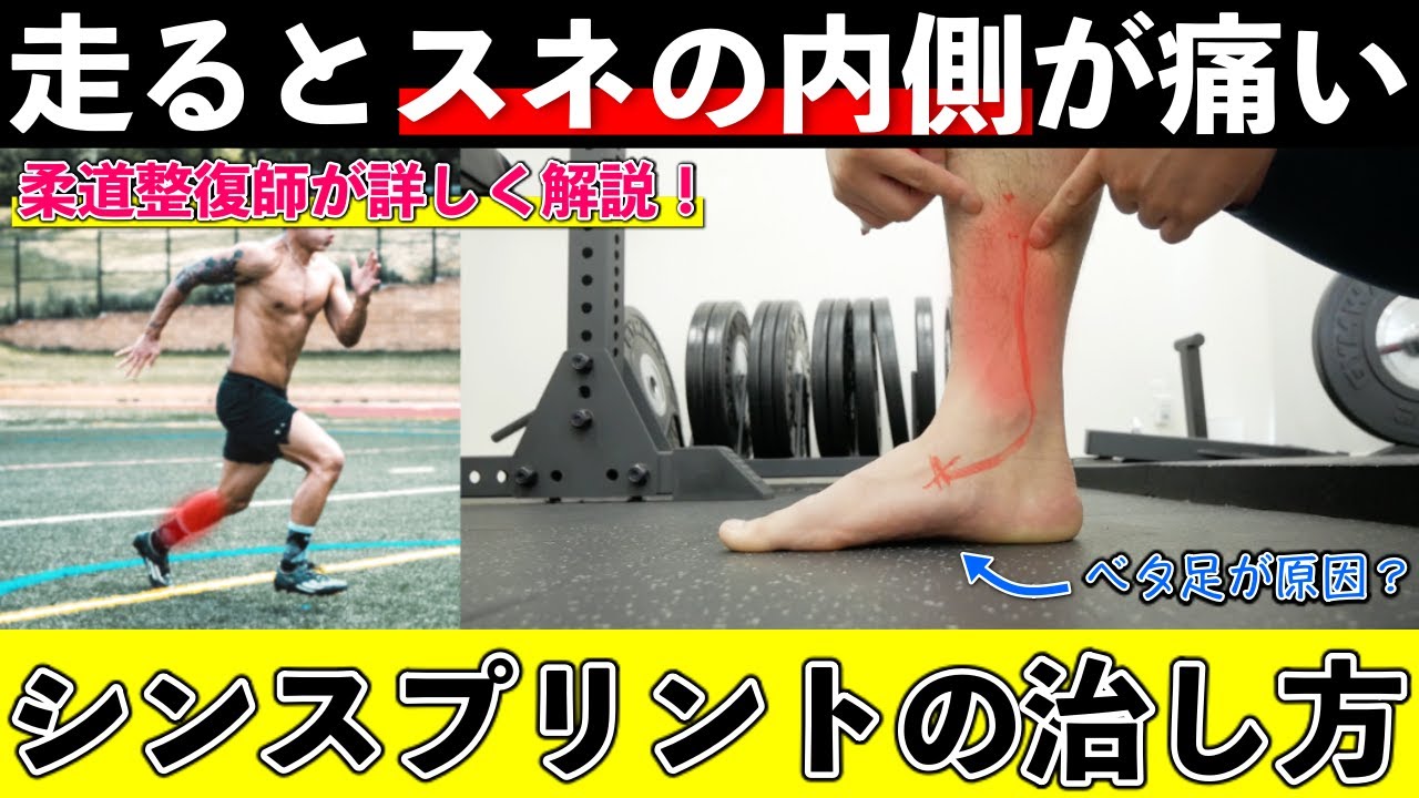 【シンスプリント】走ると『スネの内側』が痛くなる原因と改善方法【ランニング障害】