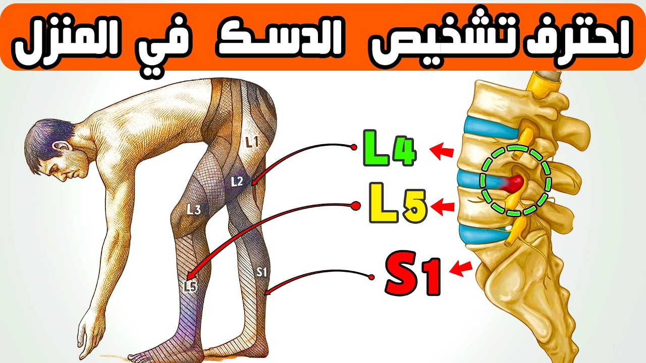 الاختبار الطبي في المنزل لتشخيص سبب ألم الظهر والأرجل || تحديد ضغط انزلاق الدسك L4-L5-S1