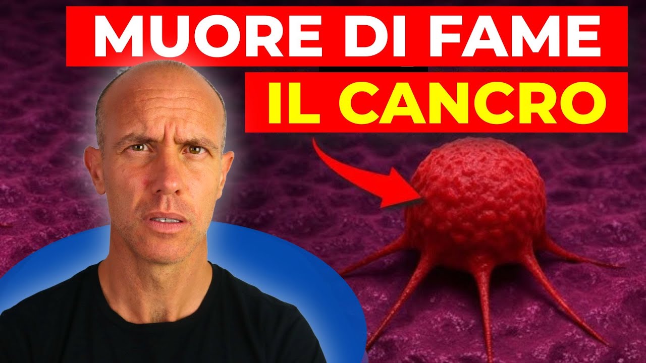 IL CANCRO PUÒ DIPENDERE DA CIÒ CHE MANGIA: la scoperta sugli AMINOACIDI