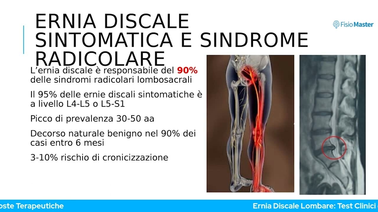 Ernia Discale Lombare  Test Clinici e proposte Terapeutiche