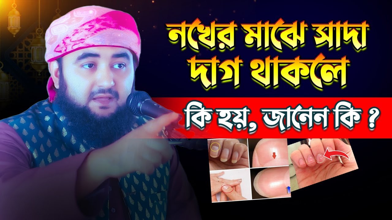 নখের মাঝে সাদা দাগ থাকলে কি হয়, জানেন কি ?