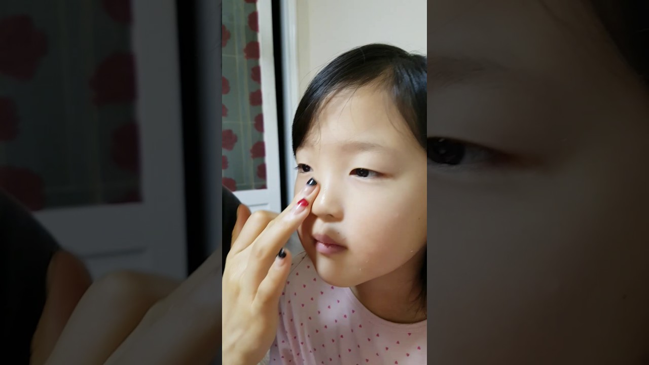 피태
