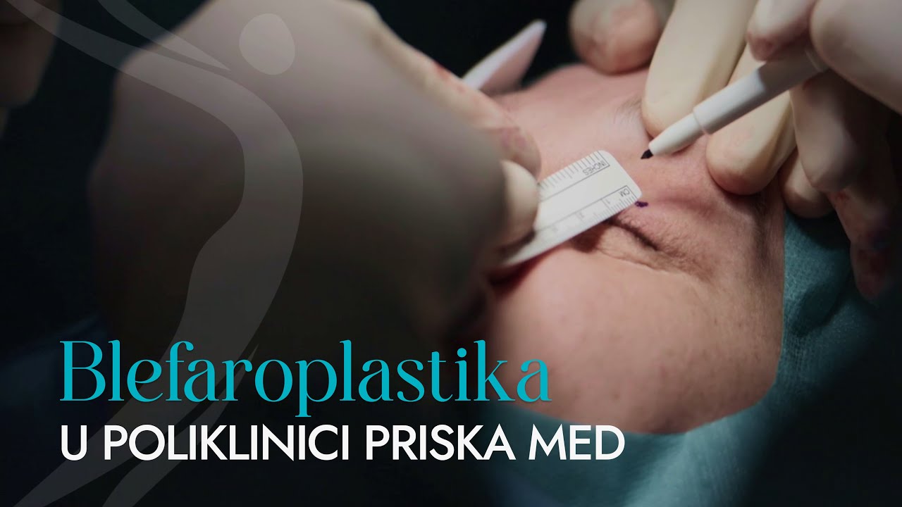 Gornja blefaroplastika u Poliklinici Priska Med