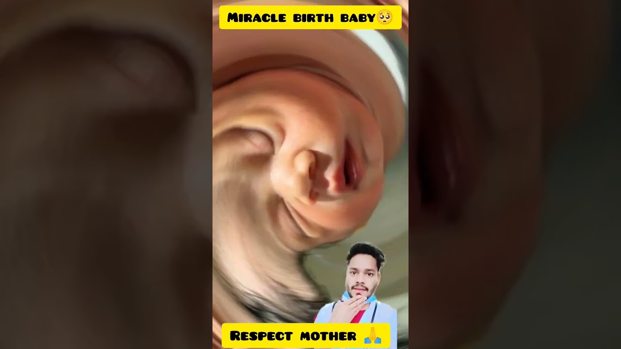 Miracle birth baby #junior #birth #miracle #baby #respectmother #lovemother