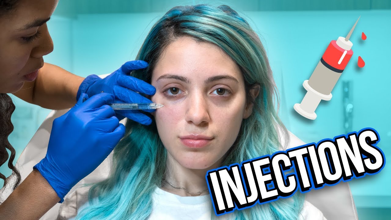 Getting Filler: why I'm doing it + my results.
