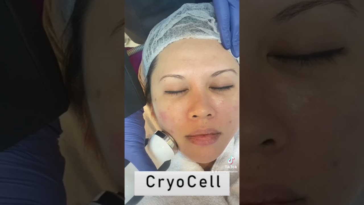 CRYOCELL