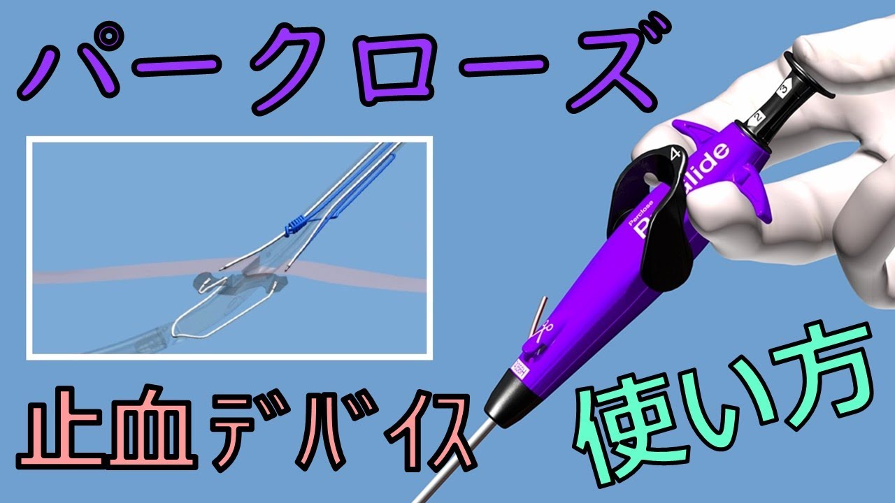 パークローズ Proglide デバイスの使い方解説（30ステップで学ぶPercloseによる止血方法の世界で一番わかり易い動画）