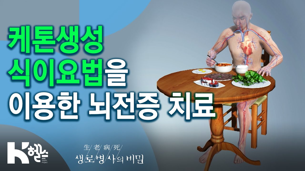 케톤생성 식이요법을 이용한 뇌전증 치료 - 734회(20.06.03) 뇌 전류의 오류, 뇌전증