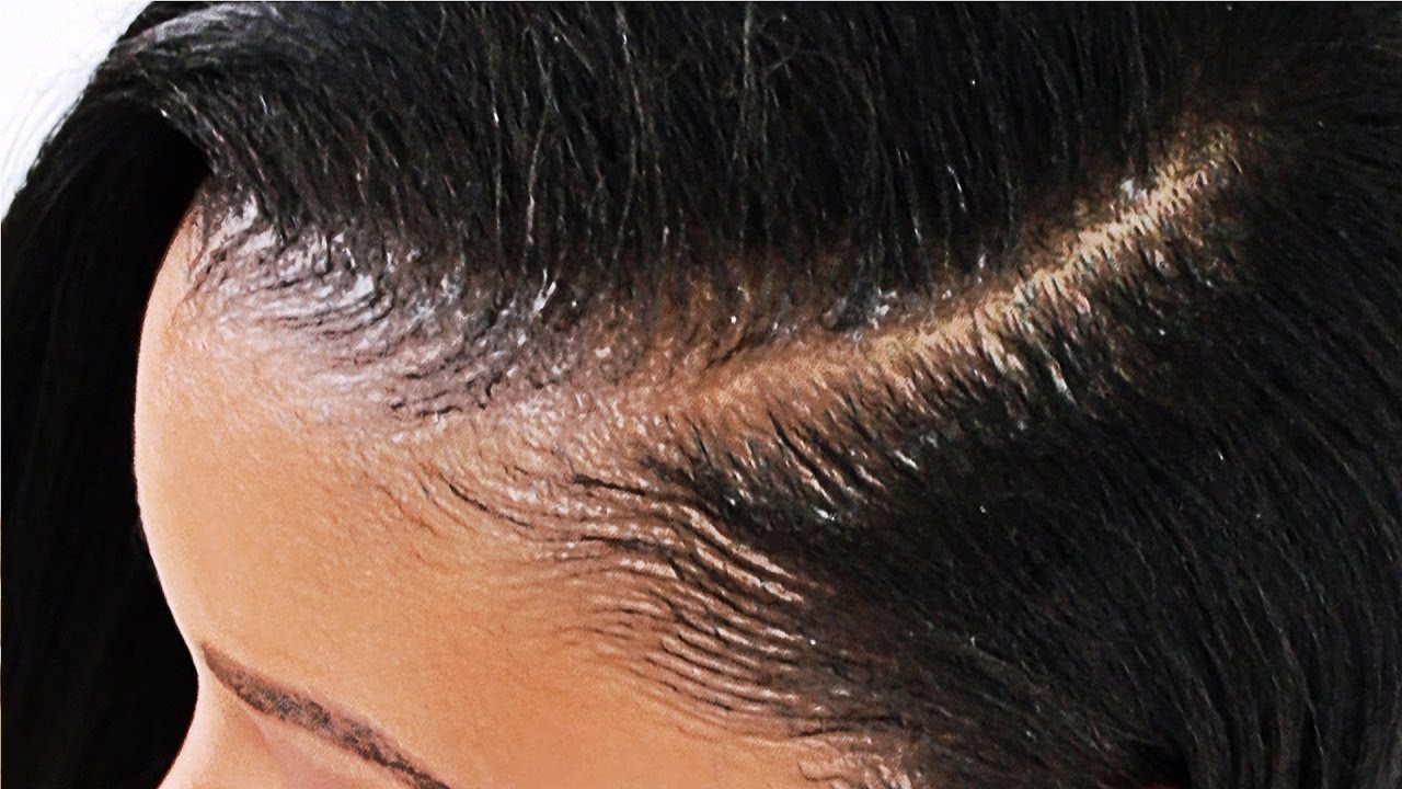 Partial Sew In Weave Tutorial IN DETAIL!