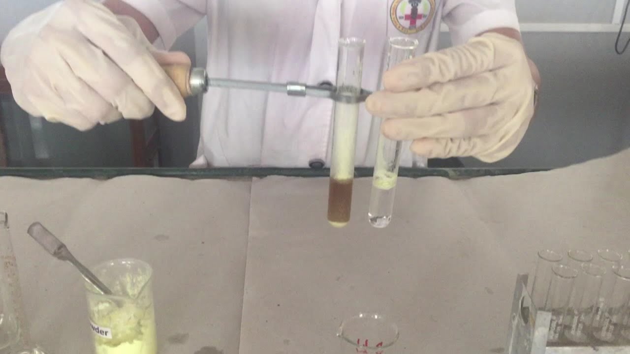 Hay's Sulfur Powder Test - for detection of bile salts in urine