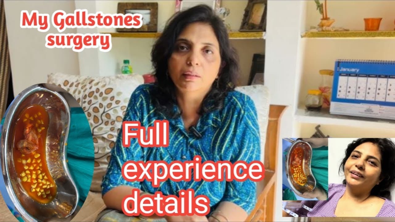 My gallstones surgery experience ll Detail video about gallstones/diet plans/side effects/ HPK-vlog 