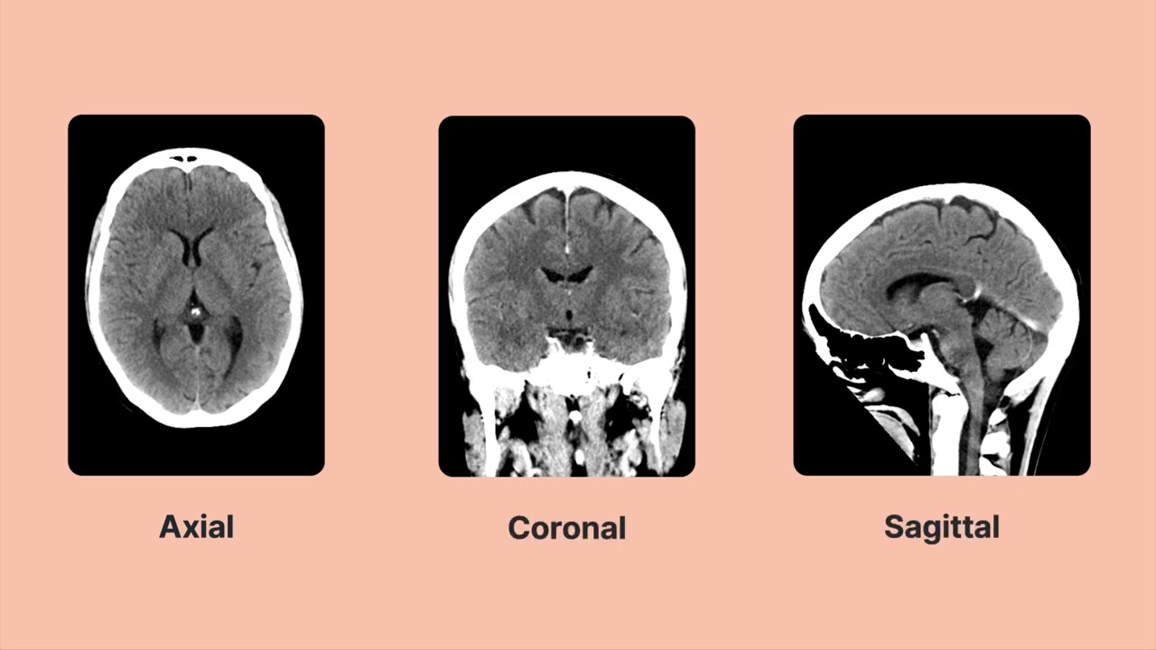 How does computed tomography (CT) work, and what is it used for?: Overview of CT imaging