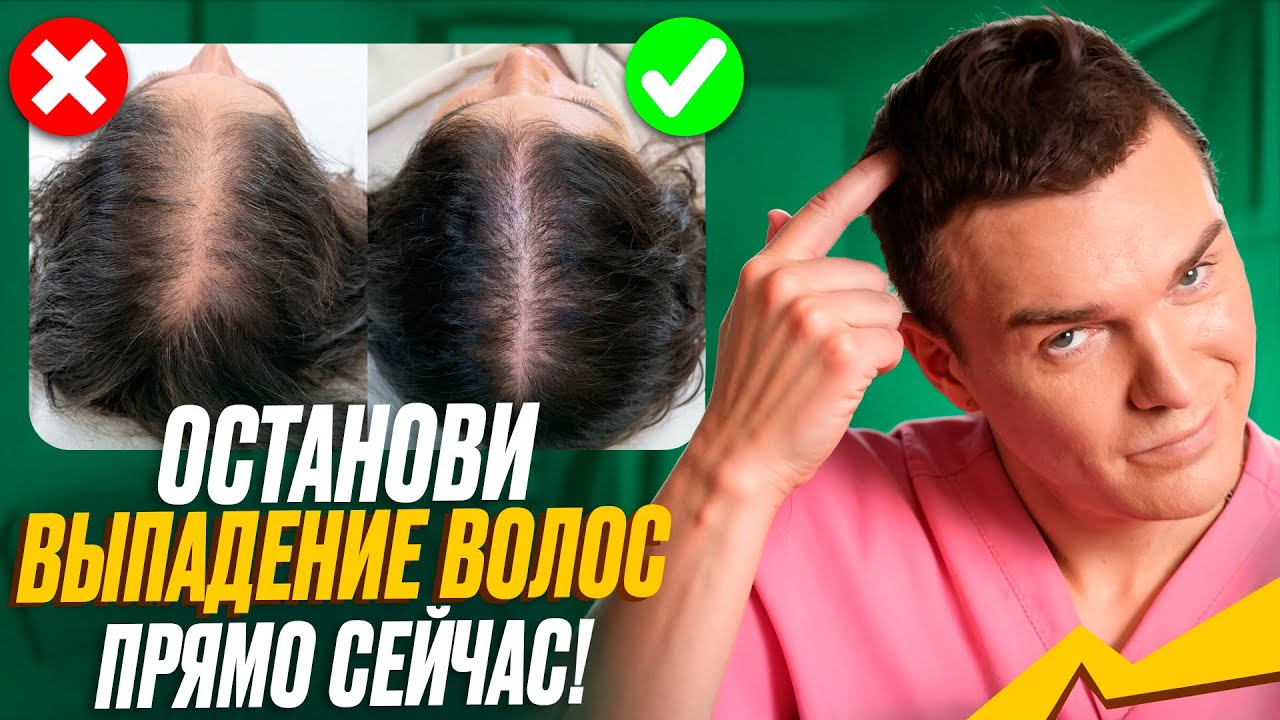 ЭТО остановит Выпадение ВОЛОС у любой ЖЕНЩИНЫ уже Сейчас!