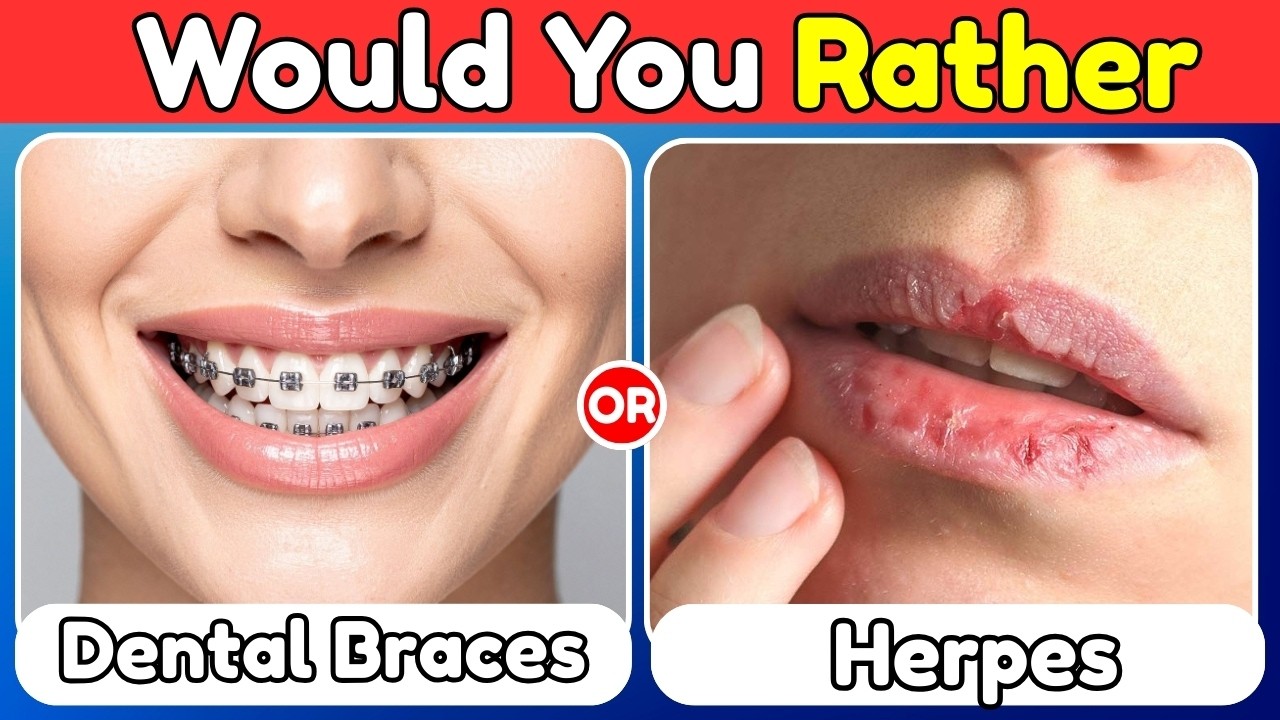 Would You rather - Most Extreme Choices Ever😱