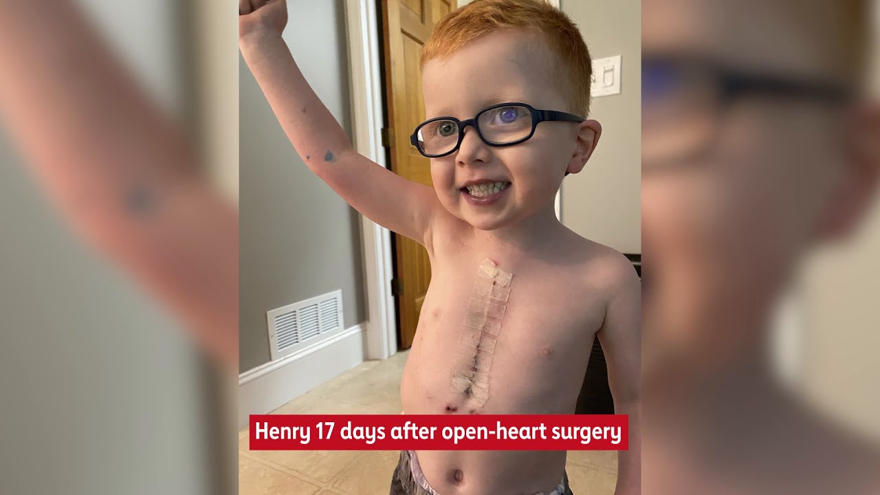 Henry's Story - 2021 Twin Cities Heart Ball