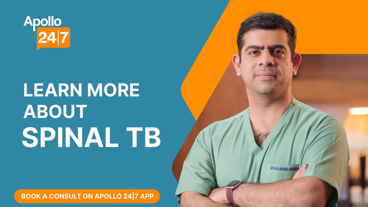 Spinal TB Treatment (In Hindi) | Dr. Saurabh Rawall