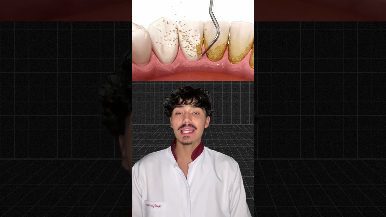 Limpeza de T&aacute;rtaro no Dentista: Como Funciona e Por Que &eacute; Importane
