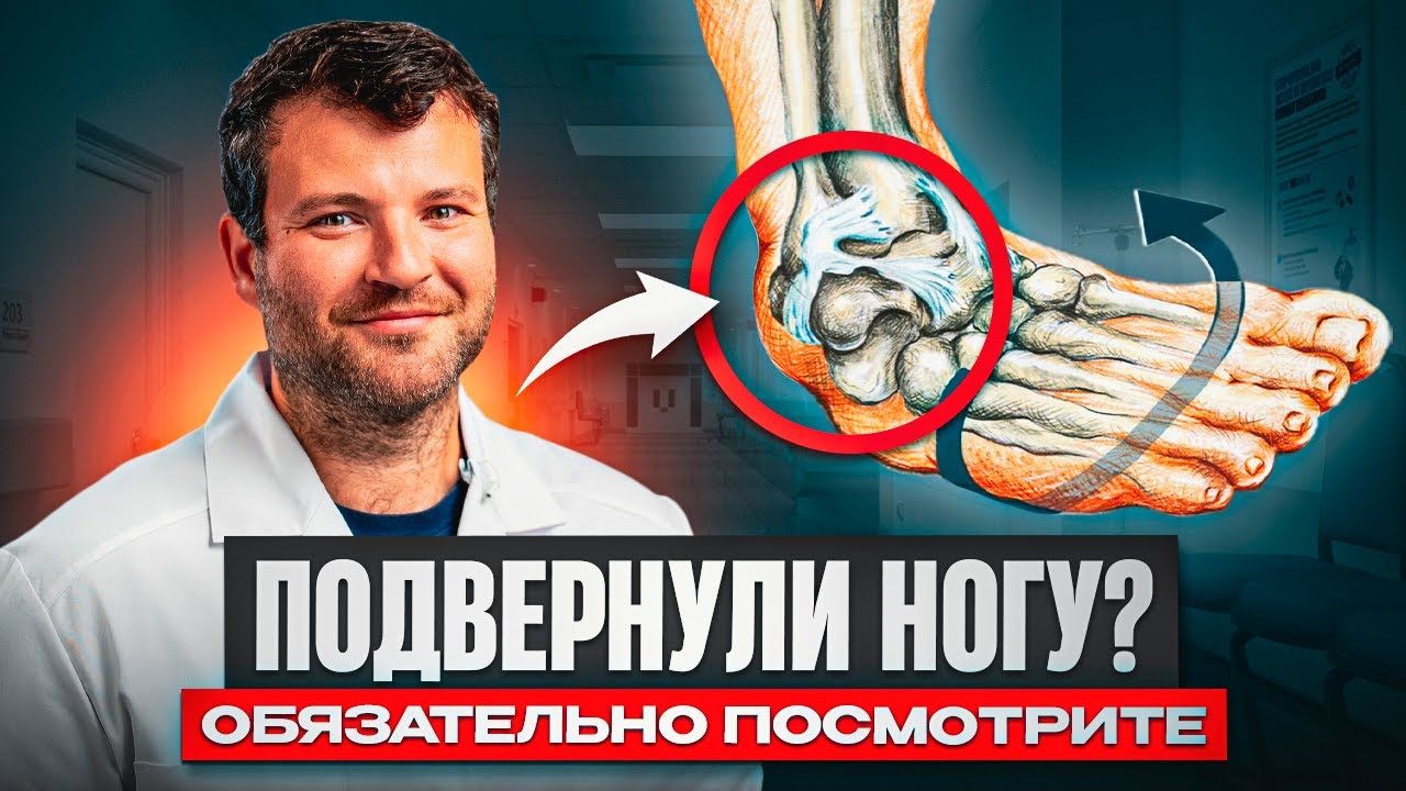 ВЫВИХ ГОЛЕНОСТОПА: что делать, если подвернули ногу