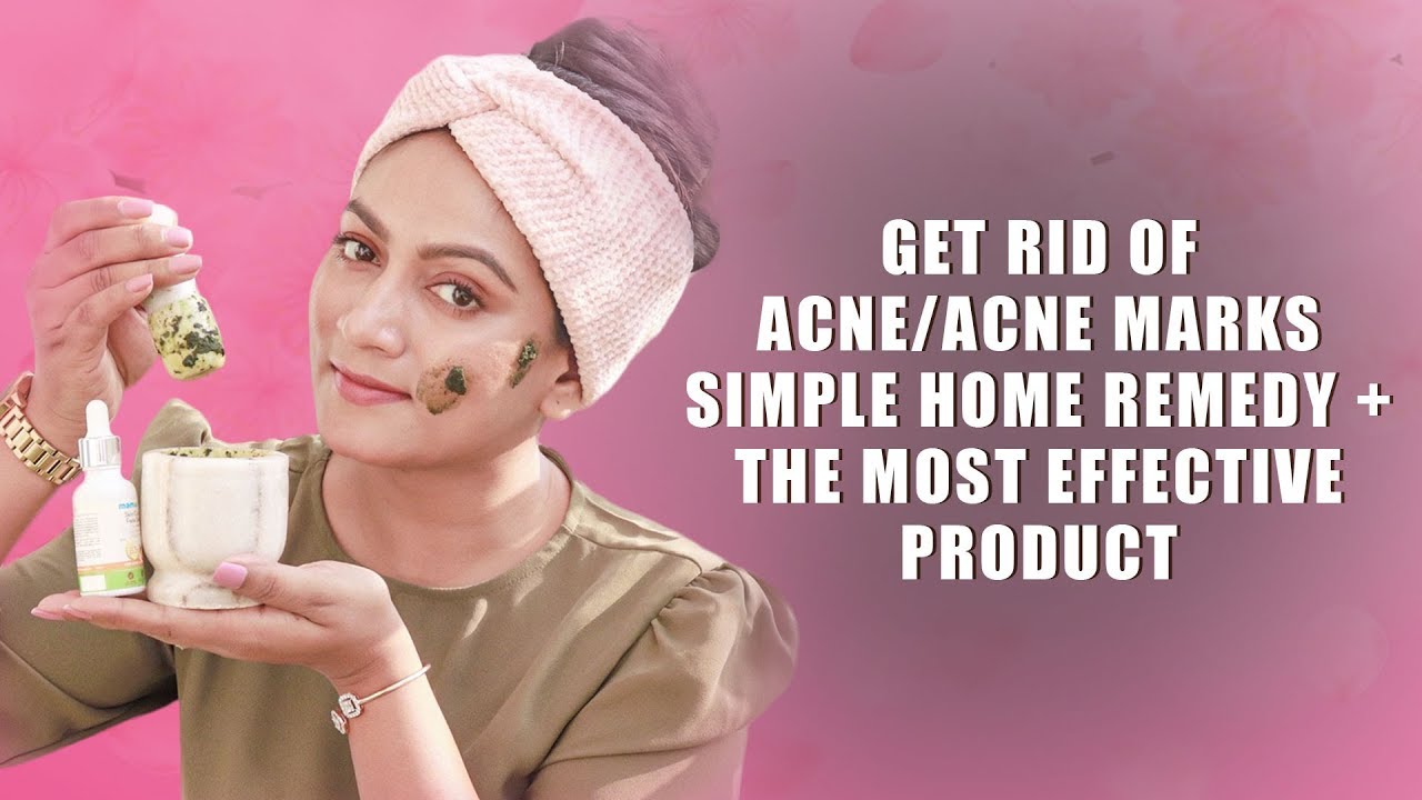 Get Rid of Acne/Acne Marks Simple Home Remedy + Best&Effective Product || Giveaway CLOSED||Ashtrixx