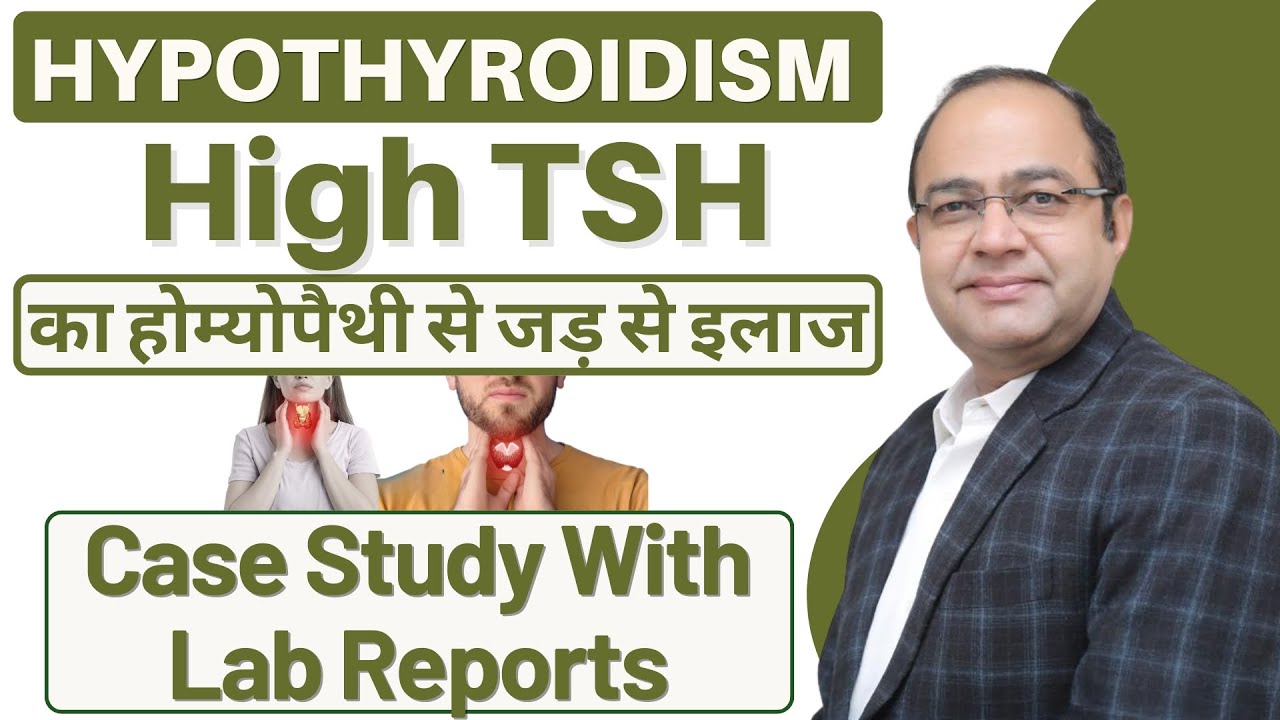 Hypothyroidism High TSH Cure | थायराइड का सफल होम्योपैथिक इलाज |Thyroid Case Study with Lab Report