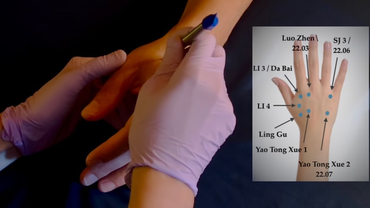 [From the Archives] Hand Acupuncture Demo ft. Tom ✋🏼🗡️🧡 [Real Person ASMR]
