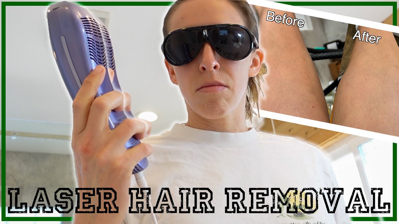 Testing an AT HOME Laser Hair Removal Tool!