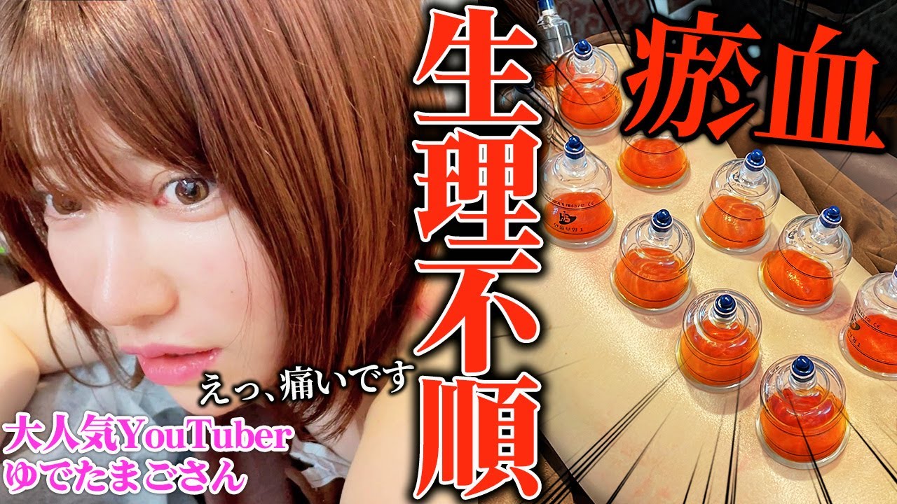 【吸い玉　生理】Youtuberゆでたまごさん治らない生理不順 女性ホルモン崩れ情緒不安定　吸い玉鍼治療でしっかり治す　自宅でできる方法伝授 @YudetamaChannel