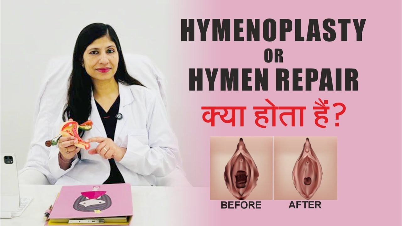 What is Hymenoplasty surgery ? Hymen Repair/ Re-Virgination surgery || Female Cosmetic Gynecologist