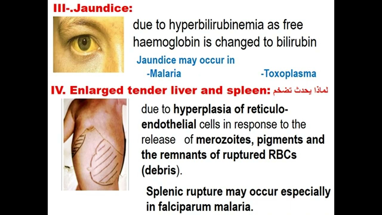 Parasitology blood module Malaria 2