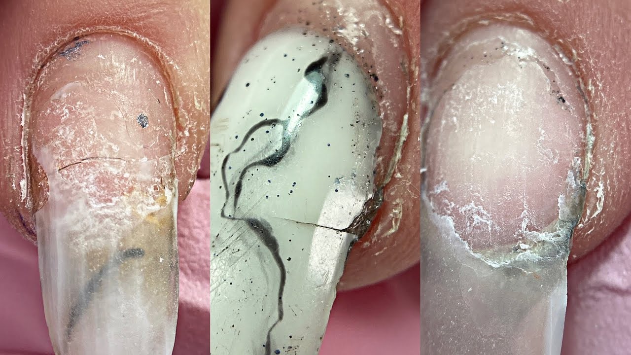 ПОЛНЫЙ ТРЕШ😱Такого я еще не видела😕Супер клей на ногтях💅 Отслойки трещины💅Маникюр