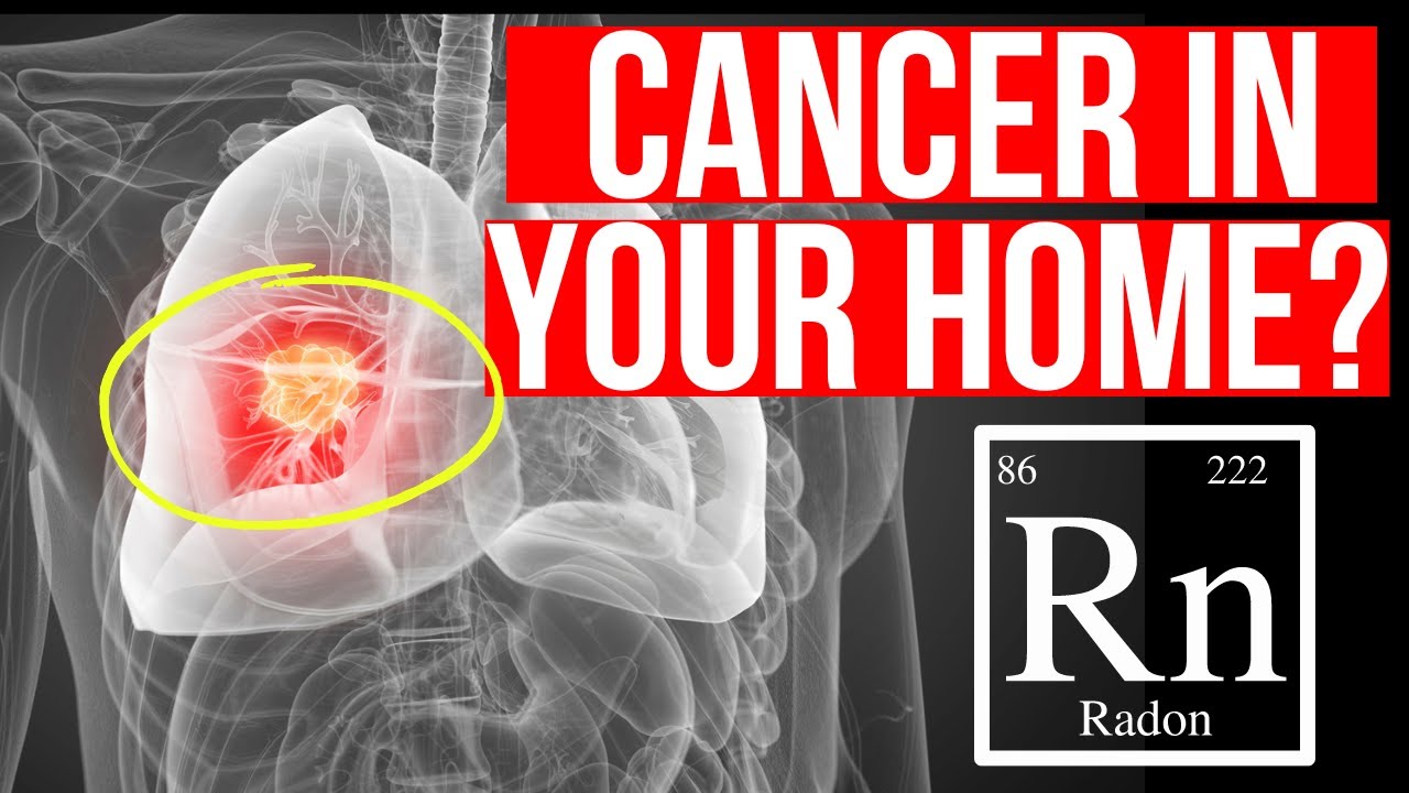 Radon and Lung Cancer | Doctor explains