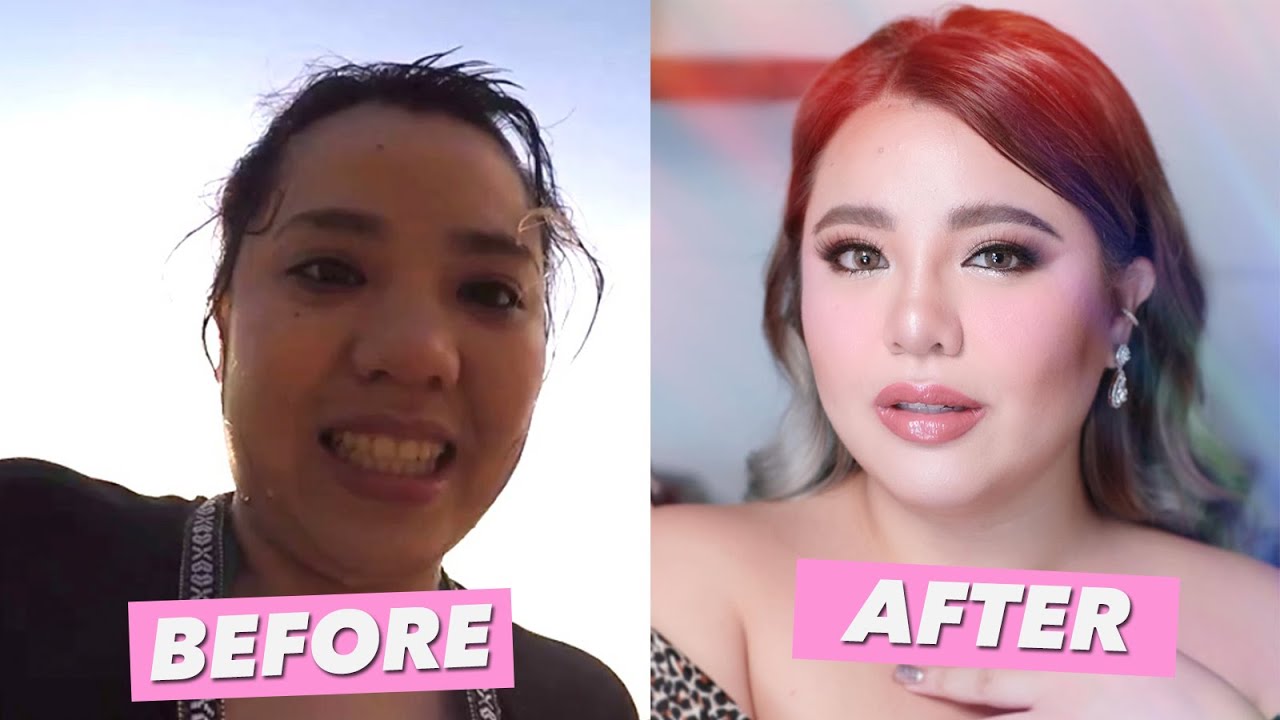MY NON SURGICAL NOSELIFT EXPERIENCE! (NAKAKALOKA ANG RESULT!!) | HelenOnFleek