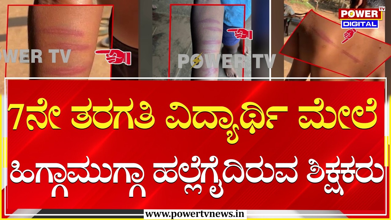 7ನೇ ತರಗತಿ ವಿದ್ಯಾರ್ಥಿ ಮೇಲೆ ಹಿಗ್ಗಾಮುಗ್ಗಾ ಹಲ್ಲೆಗೈದಿರುವ ಶಿಕ್ಷಕರು | Shivamogga | Power TV News