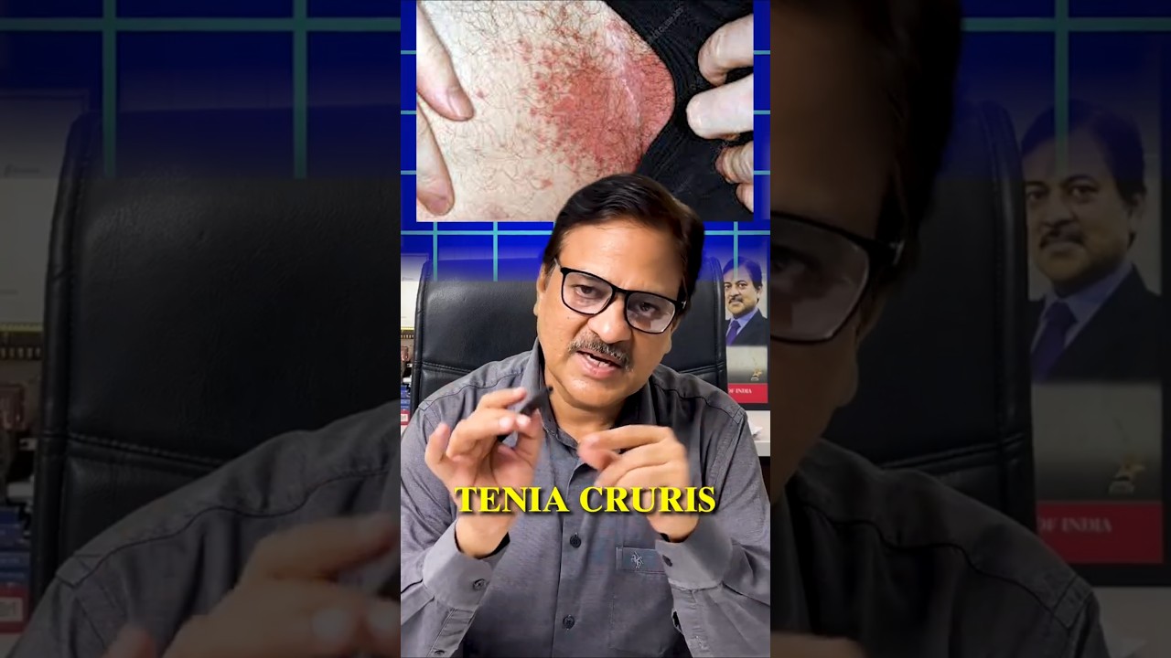 Fungal Infection prevention and treatment tips. #skincare #fungalinfection