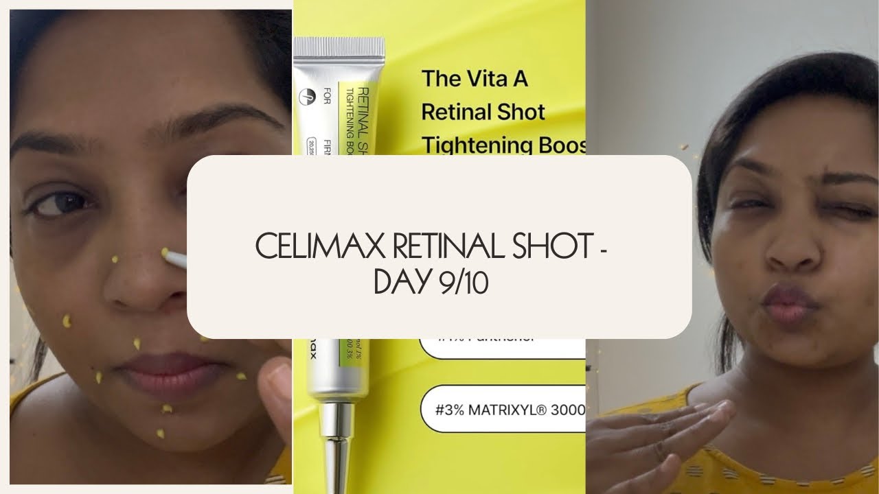 Vlog # 23 | Day 9/10 Celimax retinal shit challenge | #koreanskincare #celimax 