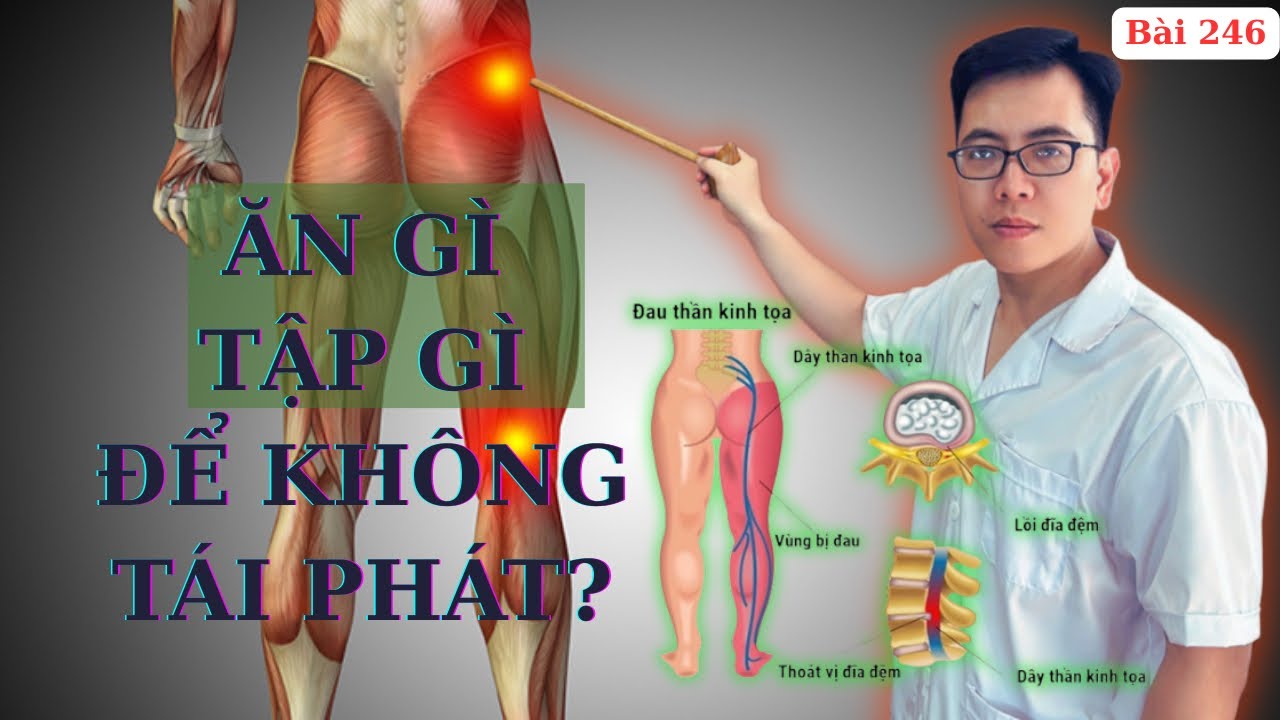 Cách loại bỏ ĐAU THẦN KINH TOẠ không tái phát bằng bài tập và chế độ ăn theo hướng dẫn của Ds Tuấn