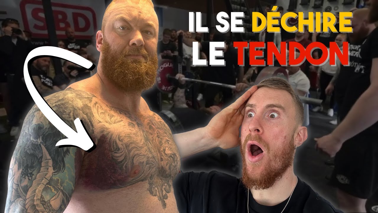 Thor Björnsson se déchire le tendon du grand pectoral !