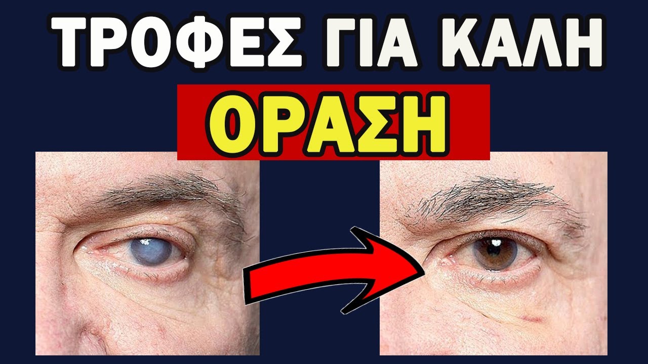 Λίστα Τροφών Που Βελτιώνουν Την Όραση 👉 Βάλτε ΑΜΕΣΑ Στην Διατροφή! | Ακαδημία Υγείας