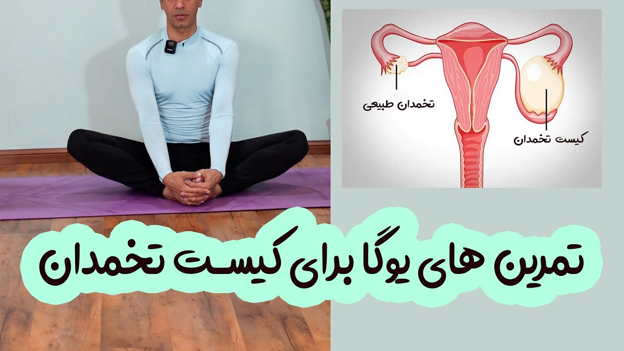 کیست تخمدان و تمرین های مناسب یوگا برای آن