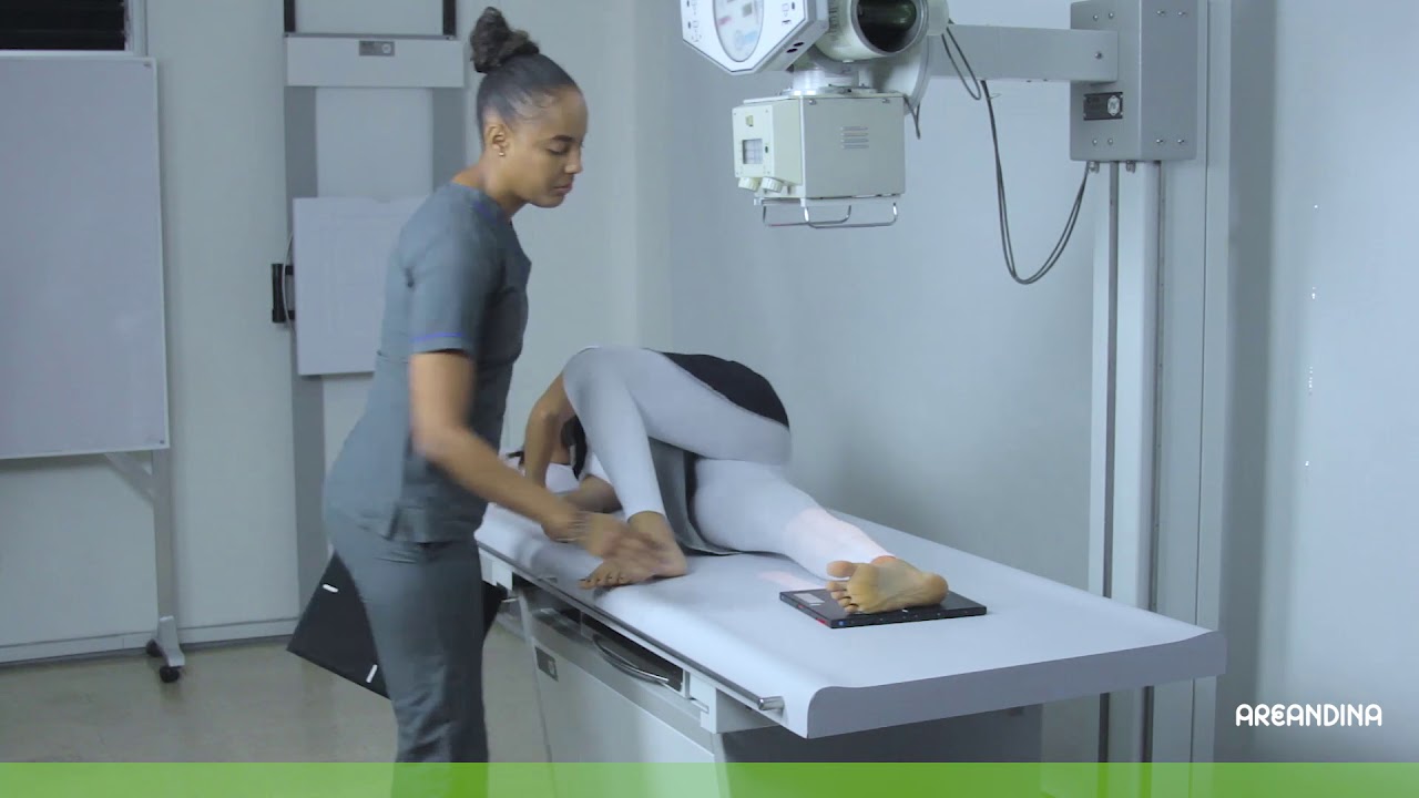 14   15   16 RADIOGRAFIA DE PIE AP OBLICUA Y LATERAL