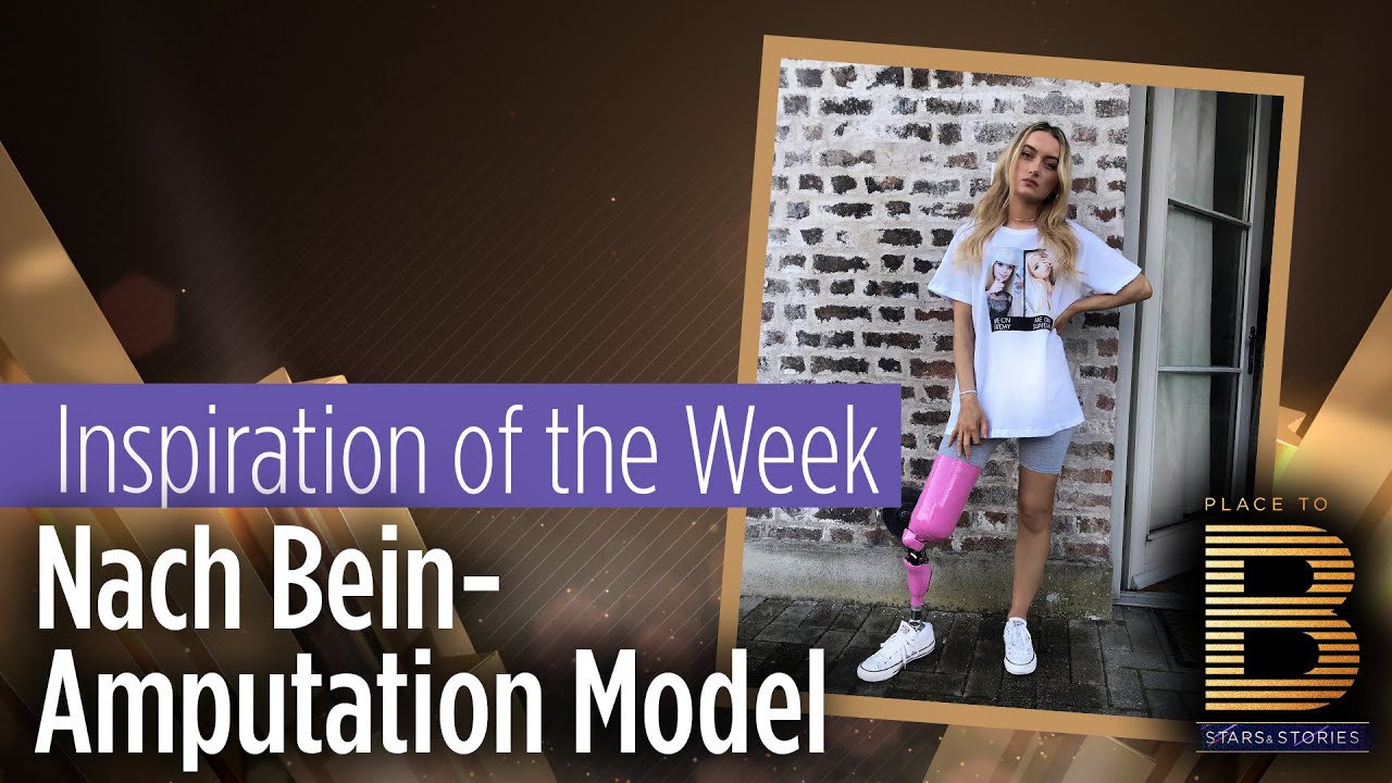 Nach Krebs: 24-Jährige wird nach Bein-Amputation Model | Place to B Stars & Stories