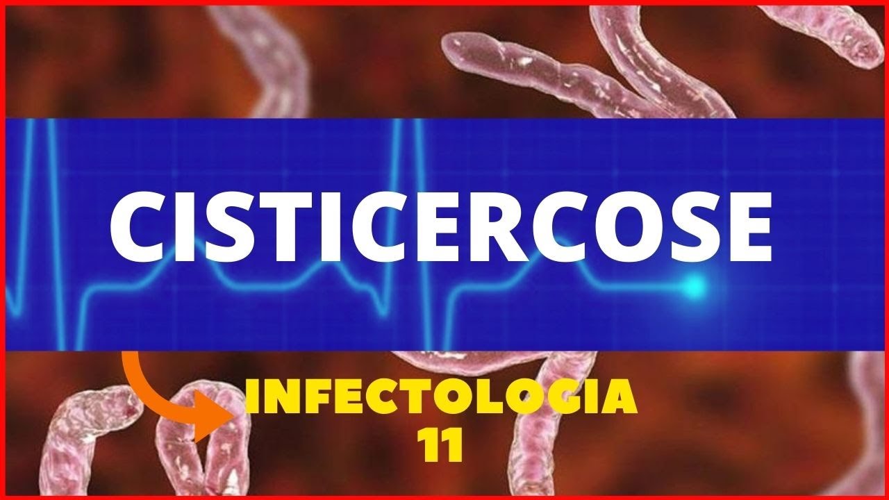 CISTICERCOSE - TAENIA SOLIUM - PARASITOLOGIA | INFECTOLOGIA