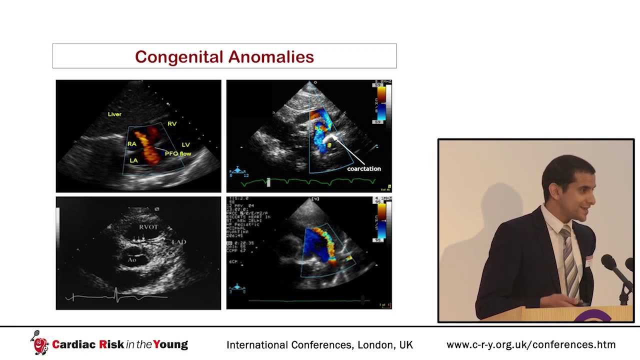 Echocardiographic assessment of the athlete's heart: Proposed protocol