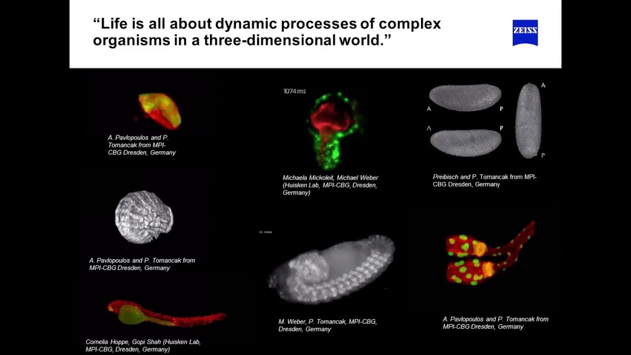 ZEISS Webinar: In Vivo and Cleared Tissue Imaging with Light Sheet Fluorescence Microscopy