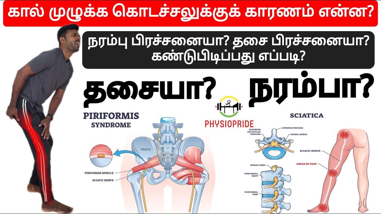 இடுப்பு முதல் கால் முழுக்க வலி,கொடைச்சல் இருக்கா?எதனால் வலி வருது?கண்டுபிடிச்சி குறைக்க பயிற்சிகள்?