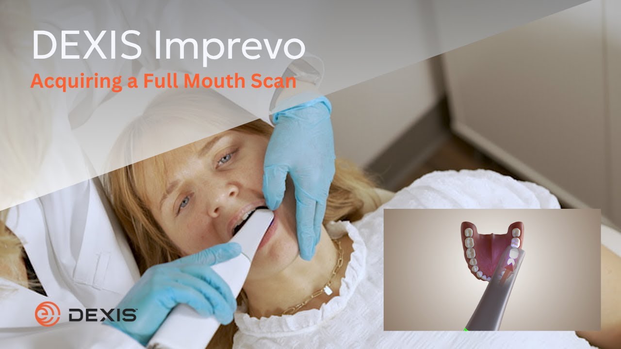 DEXIS&trade; Imprevo - Acquiring a Full Mouth Scan