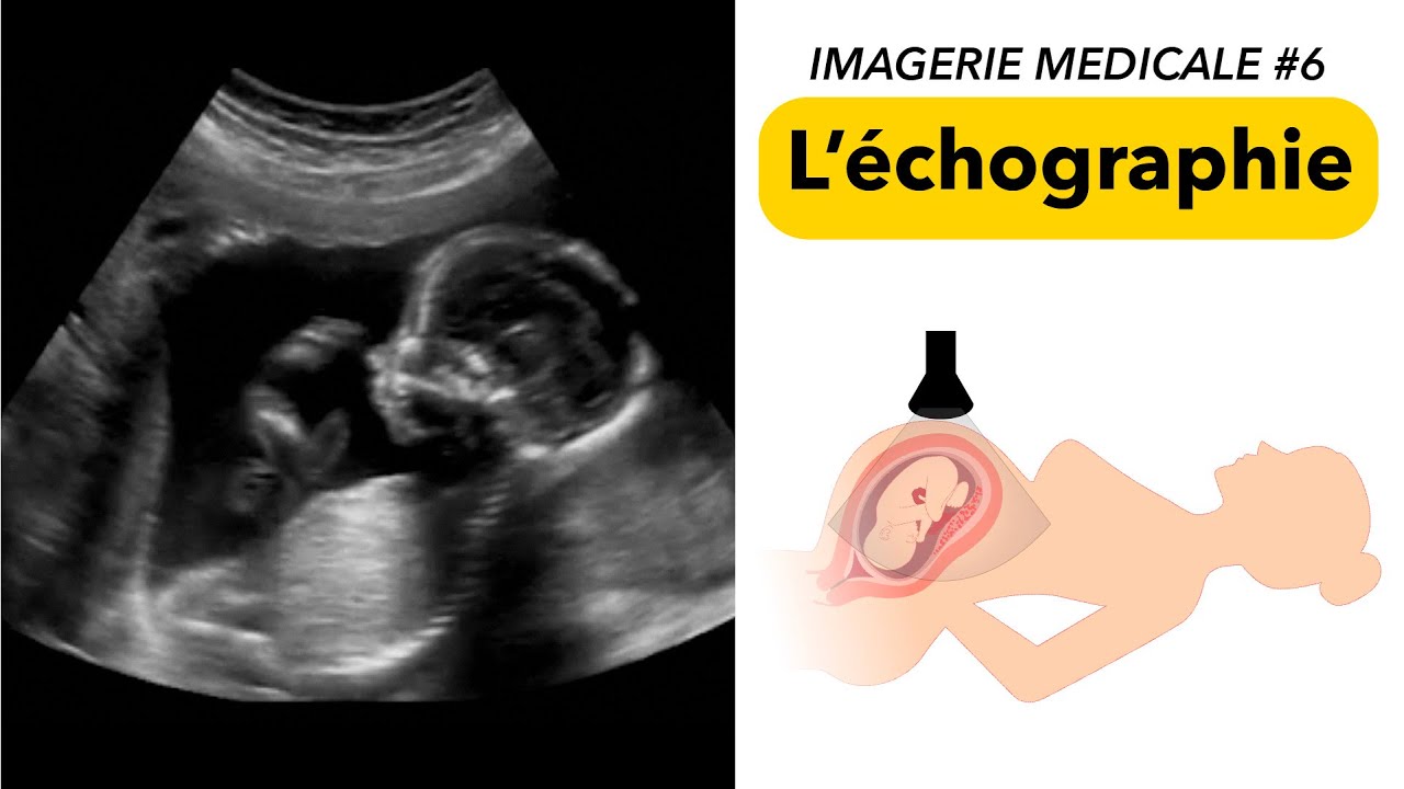IMAGERIE MÉDICALE #6 : L’échographie