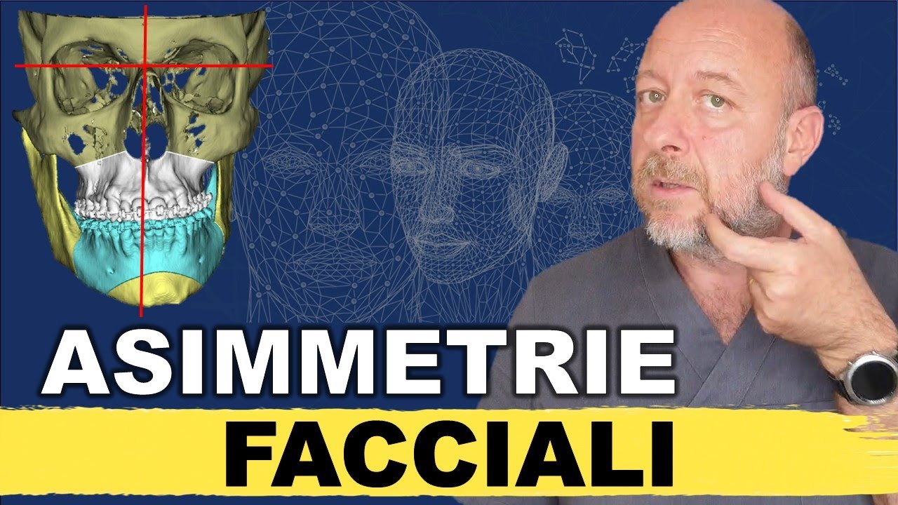 Asimmetria facciale: perché hai un viso asimmetrico e come correggerlo con il bimascellare