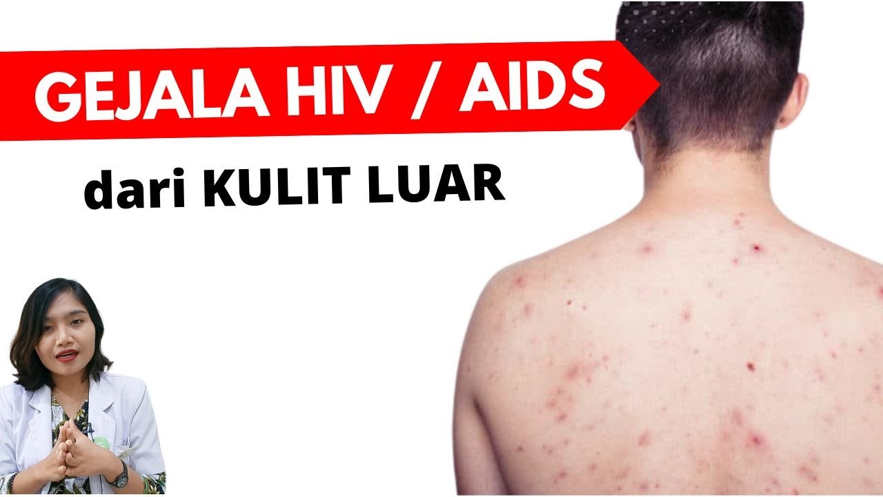 9 Gejala HIV AIDS dari KULIT LUAR | dr.Emasuperr
