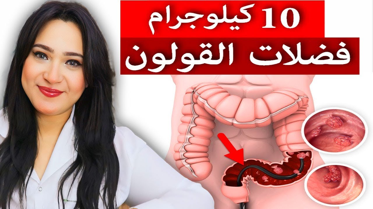 وصفة فعالة 100% لعلاج الإمساك نهائيا والتخلص من الفضلات المتحجرة والتهابات القولون والغازات !!